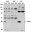 BIK1 | Botrytis-induced kinase 1